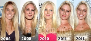Heidi Montag's transformation
