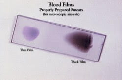 Blood Films