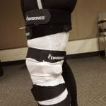 Photo of the leg brace strapped on patient's leg