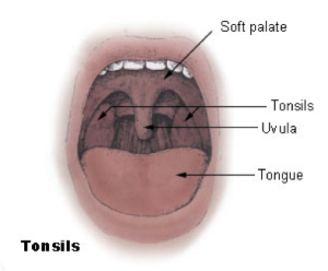 Tonsils1