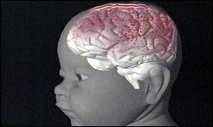 baby-brain
