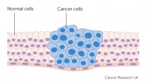 cancer-cells-growing