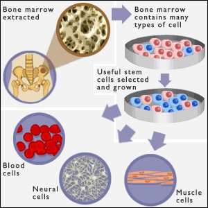 disadvantages of stem cells