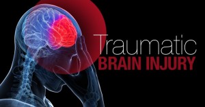 http://www.bdjinjurylawyers.com/wp-content/uploads/2016/05/header-traumatic-brain-injury-lawyer.jpg